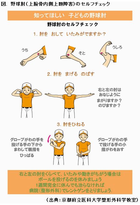 野球少年の肘を守れ！ セルフチェックで早期発見を | 健康百科