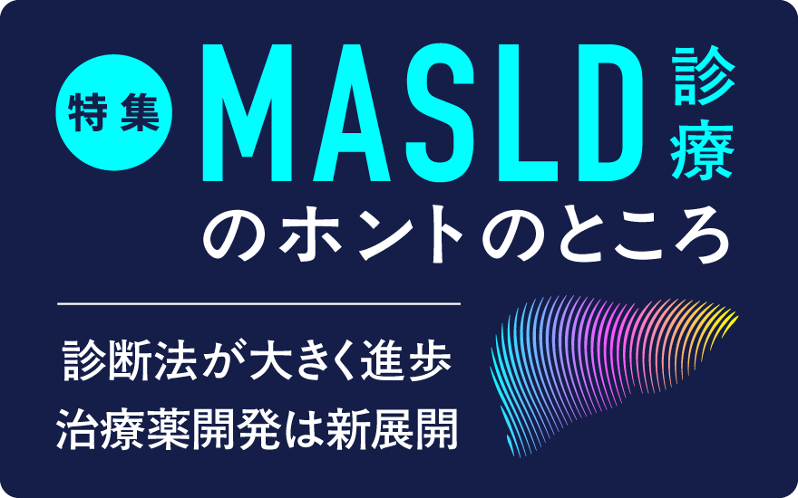 サービス