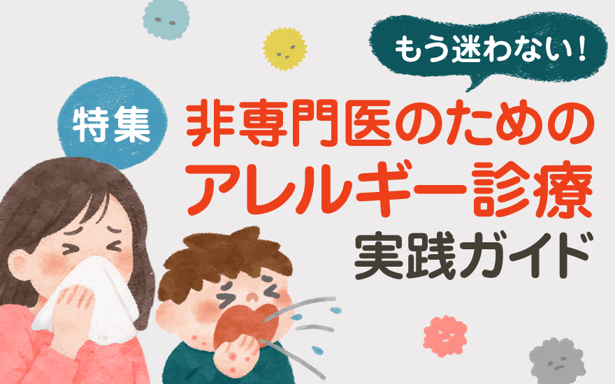 サービス