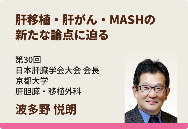 肝移植・肝がん・MASHの新たな論点に迫る／波多野 悦朗先生
