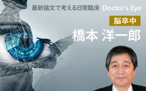 次々と登場する片頭痛予防薬、臨床での選択は