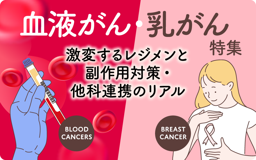 サービス