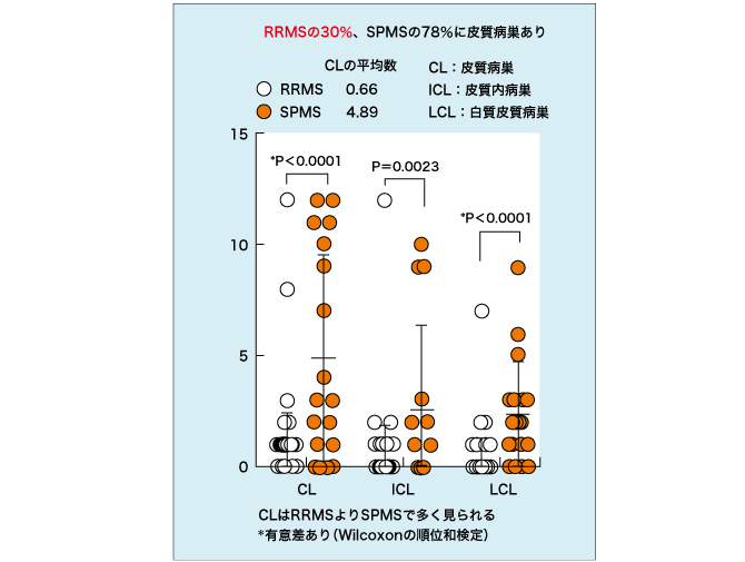 多発性硬化症の診断と治療   /新興医学出版社/吉良潤一（単行本） 多発性硬化症の障害度などをマーカーで判定 | 医学ニュース | Medical