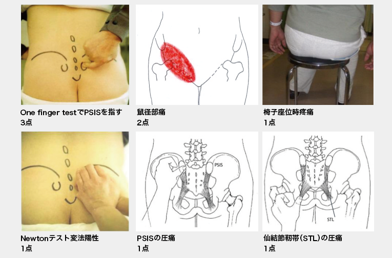 腰痛診療円滑化の鍵は