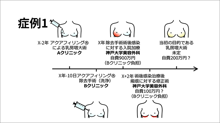 美容外科業界独自の補償制度を！ | 医学ニュース | Medical Tribune