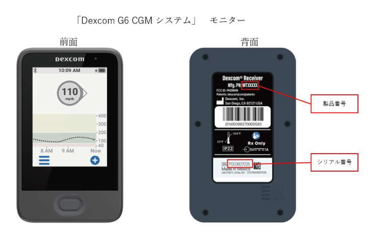 Dexcom G6、アラート／アラーム機能に不具合 | 医学ニュース