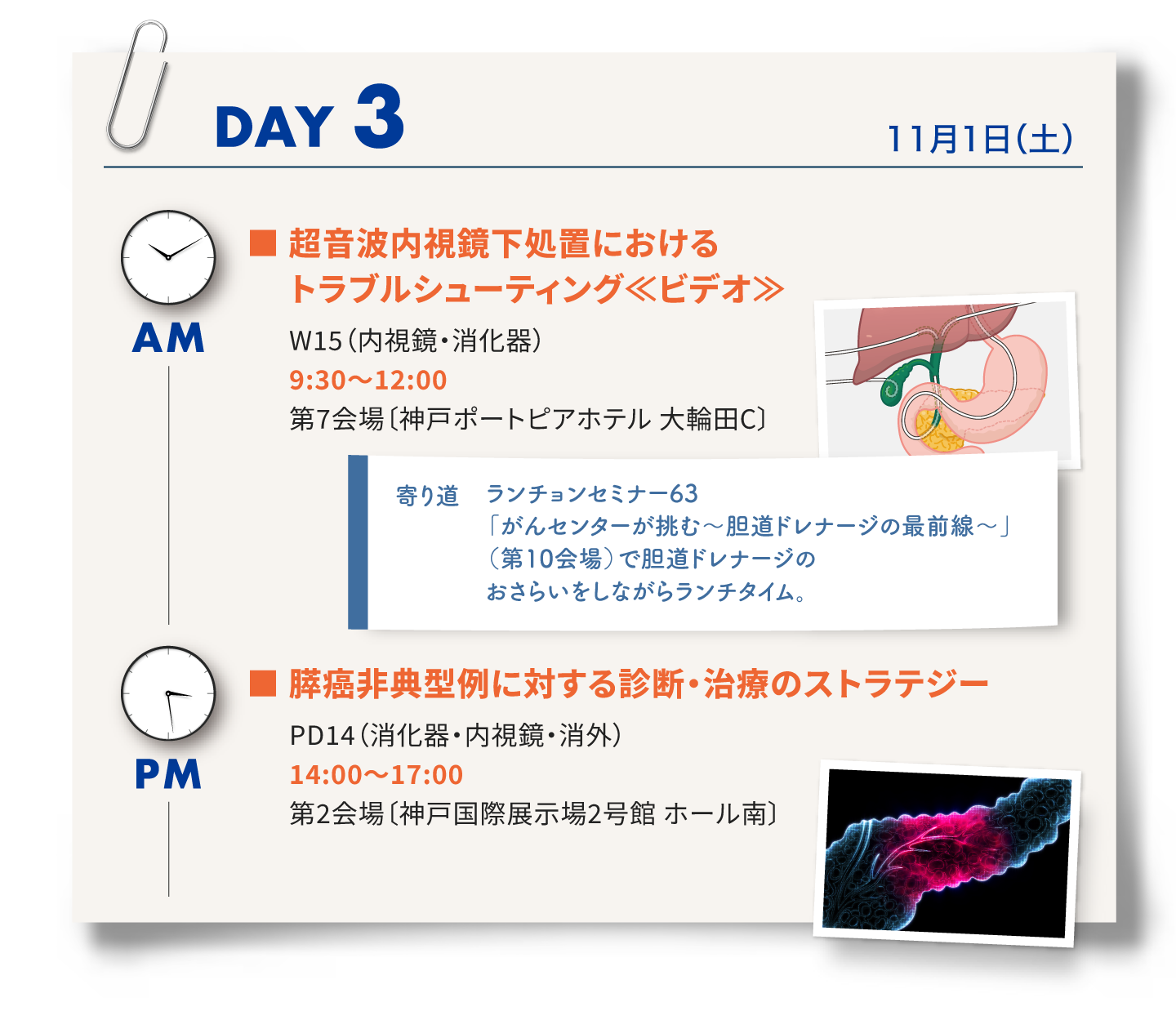 3日目は、ワークショップ15「超音波ないし教科書地におけるトラブルシューティング」、ランチョンセミナー63、パネルディスカッション14「膵がん非典型例に対する治療のストラテジー」
