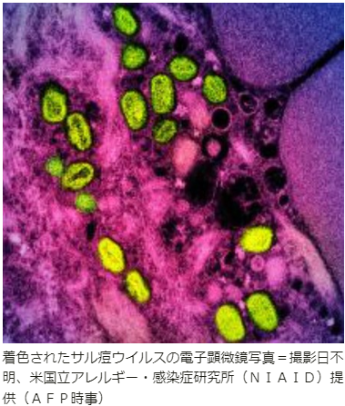 jijiサル痘ウイルス20230512.png