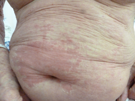 1803045_q1_2.jpg