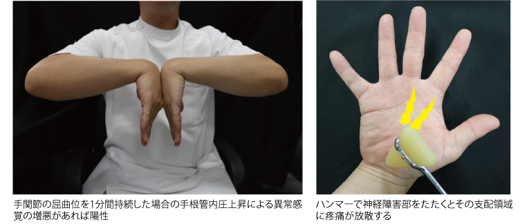第5回〕心アミロイドーシス診療ガイドライン | 日本心臓病学会監修