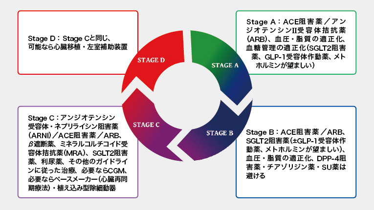 心不全は糖尿病合併症！ 薬剤選択にも要注意 | ドクターズアイ 山田悟