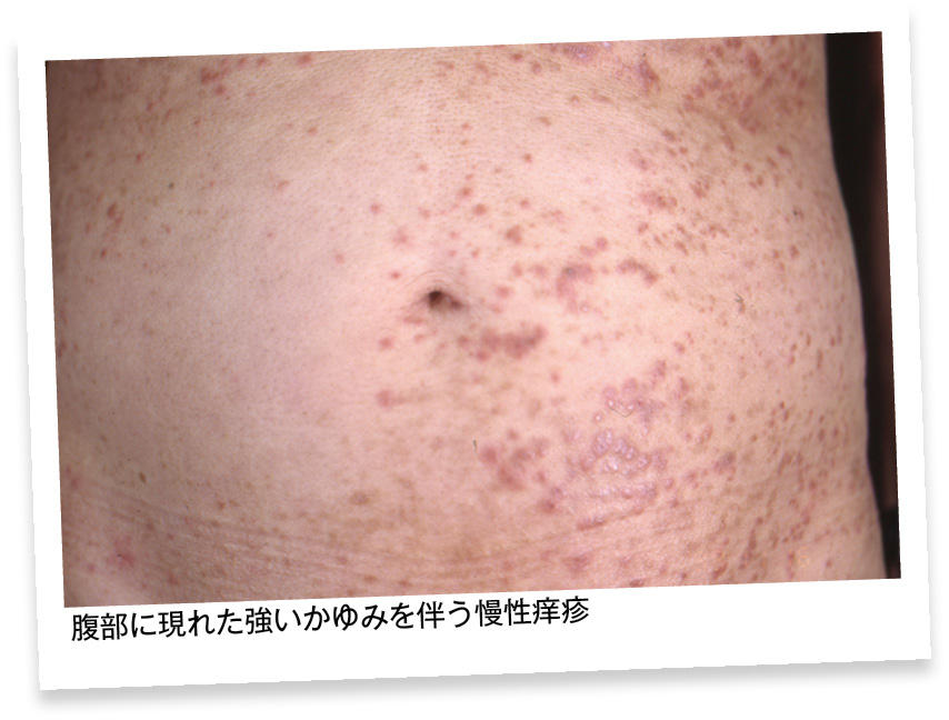 derm5_fig1-thumb-854x648-946.jpg