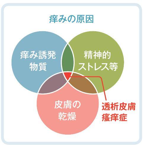 PT51_hihuka3.JPG