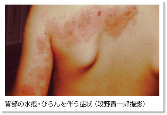 PT54_hihuka2.jpg
