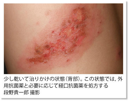 PT55_hihuka3.jpg