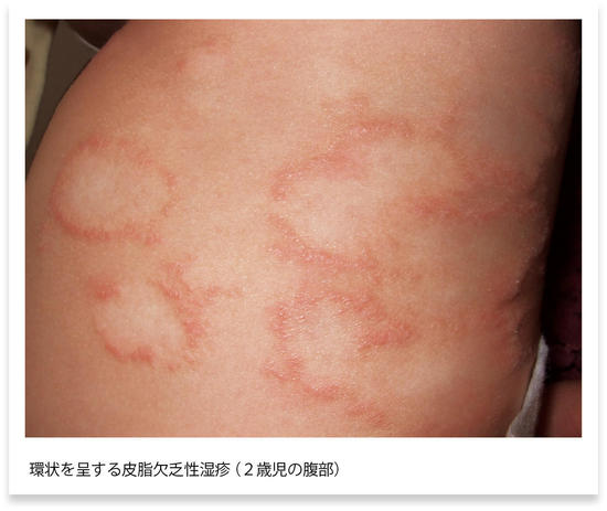 derm11_2.jpg