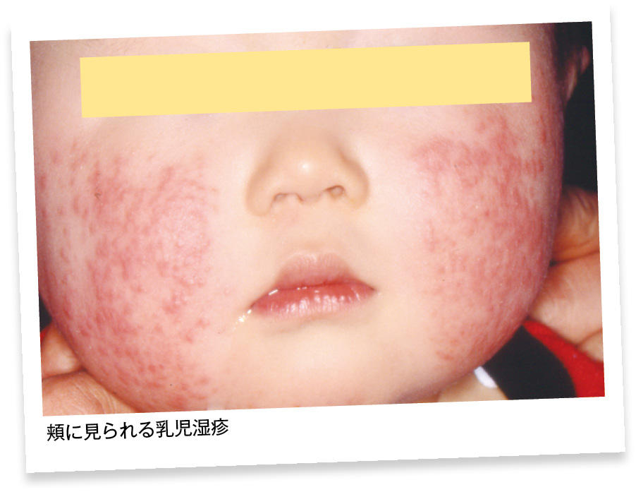 derma3_fig1.jpg