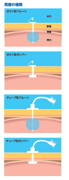 201010p11_01.png